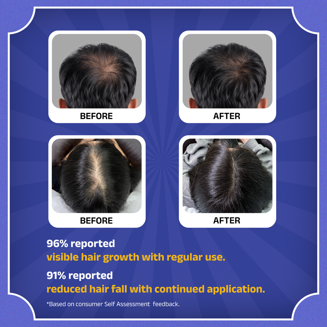 Rockstar Advanced Hair Growth Serum