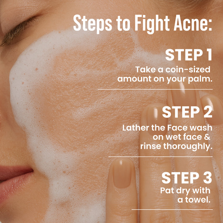 Salicylic Acid Face Wash For Acne Prone Skin
